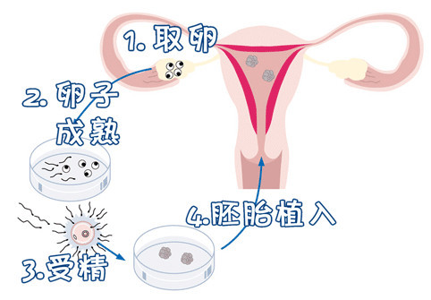 Geri培养箱